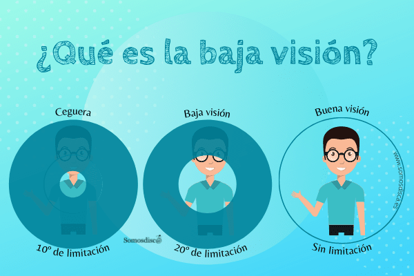 Baja visión Somosdisc