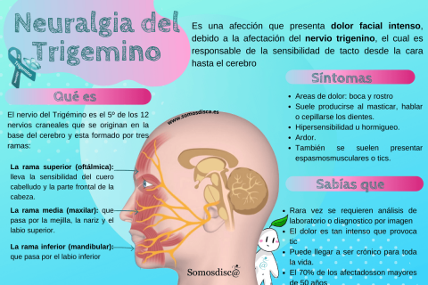 Qu Es La Neuralgia Del Trig Mino Somosdisc