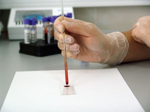 Inventan un análisis de sangre para medir el dolor que sentimos