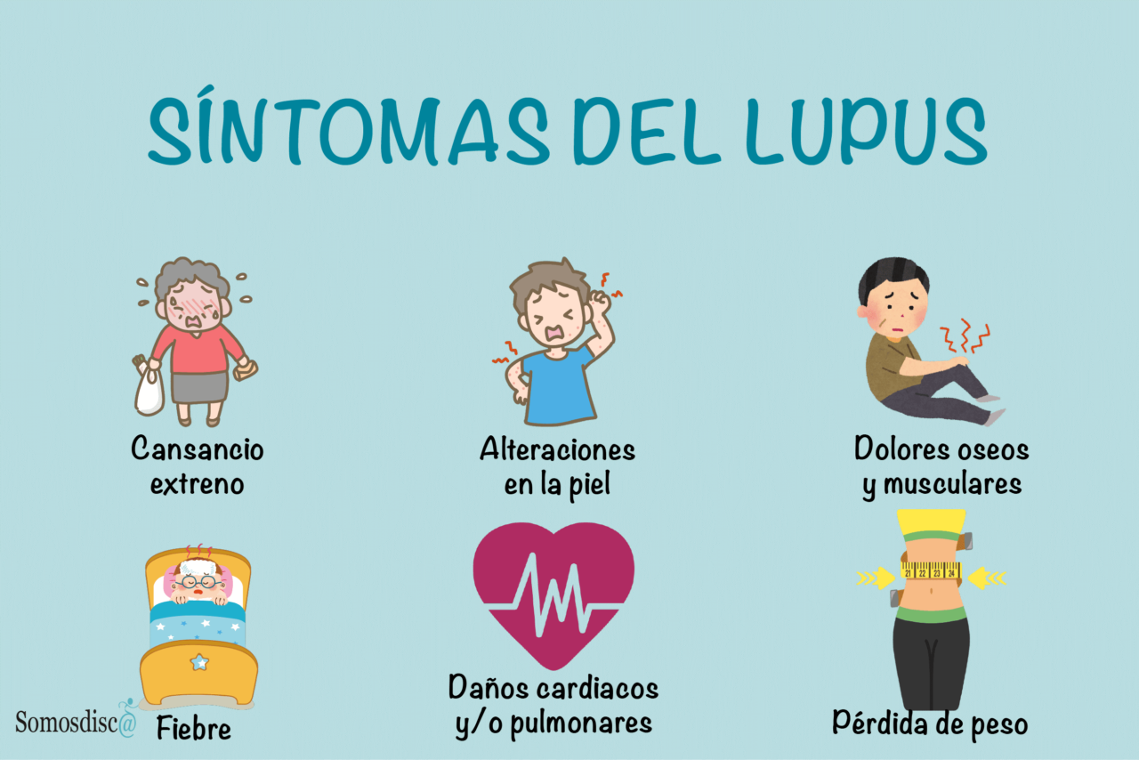 ¿qué Es El Lupus Somosdiscemk 1842