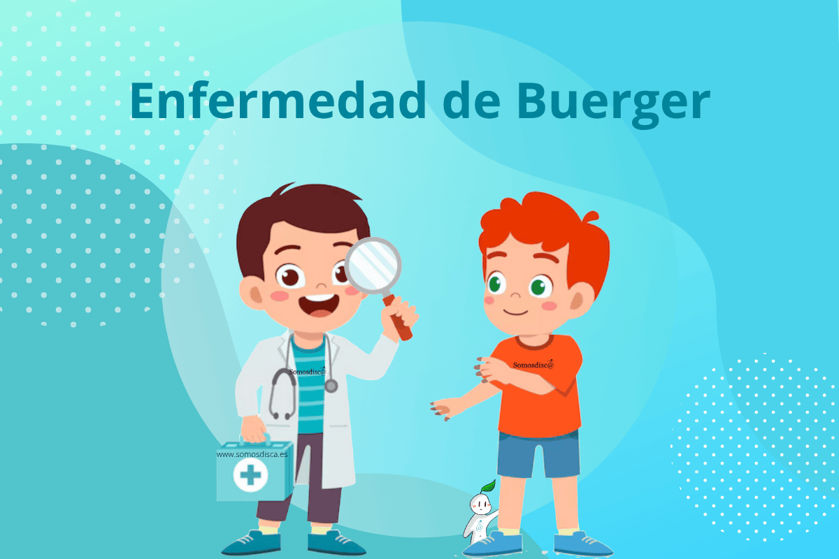 Enfermedad de Buerger Enfermedad de Buerger