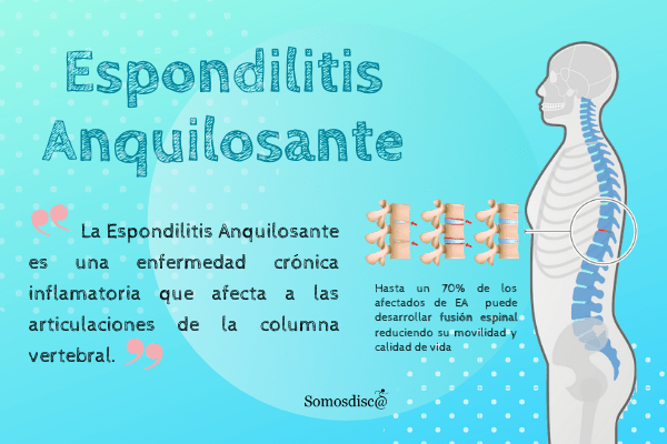 La Espondilitis Anquilosante