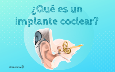 Implante coclear