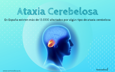 Ataxia Cerebelosa