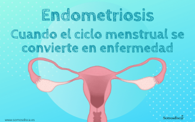 Endometriosis, cuando el ciclo menstrual se convierte en enfermedad