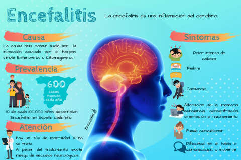 ¿Qué Es La Encefalitis? - Somosdisc@