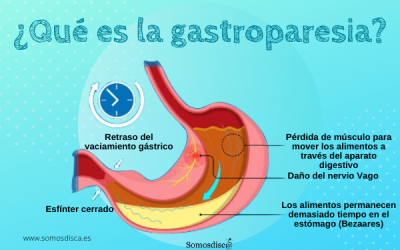 ¿Qué es la gastroparesia?