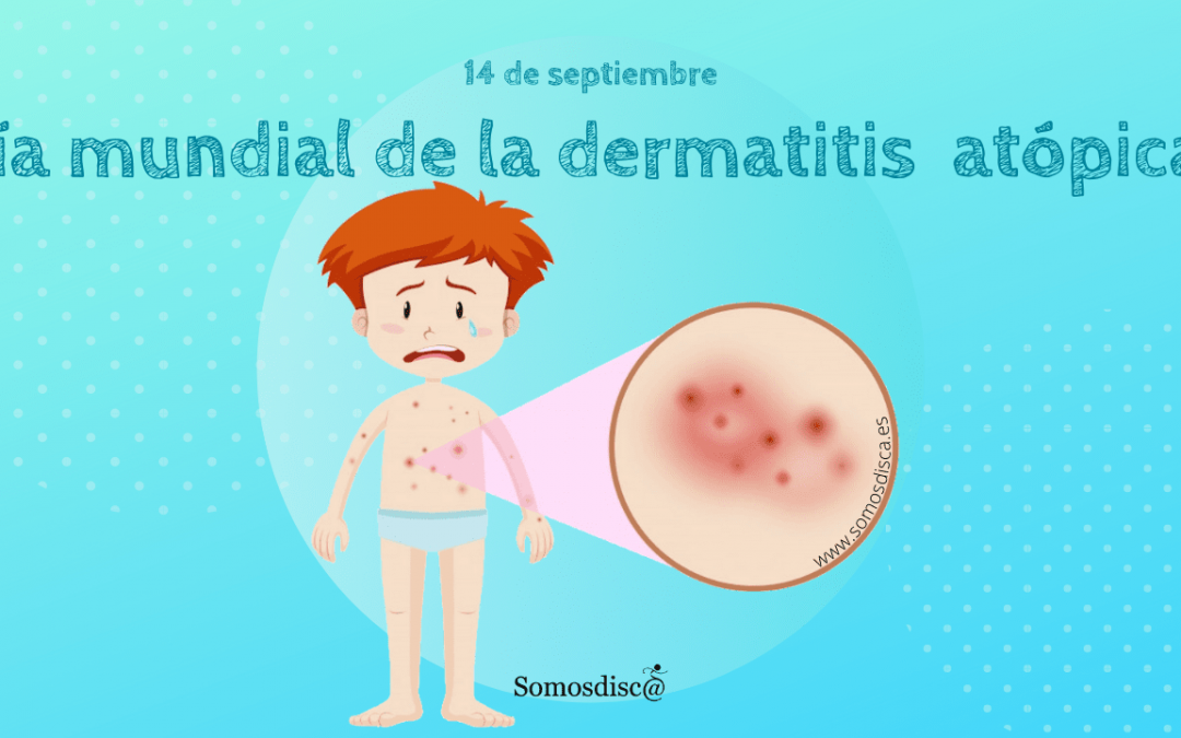 Día mundial de la dermatitis atópica