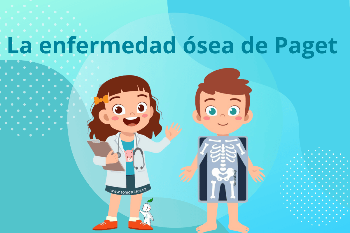 La enfermedad ósea de Paget enfermedad ósea de Paget