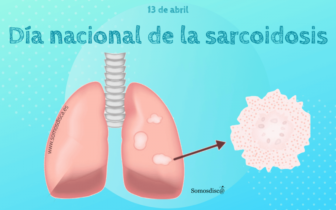 Día nacional de la sarcoidosis