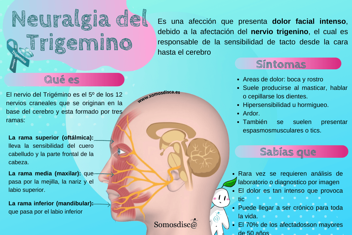 infografía Neuralgia del Trigemino