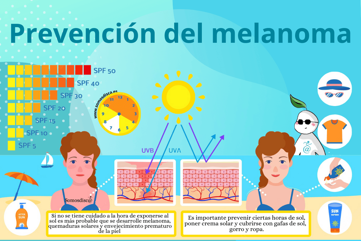 Prevención del melanoma