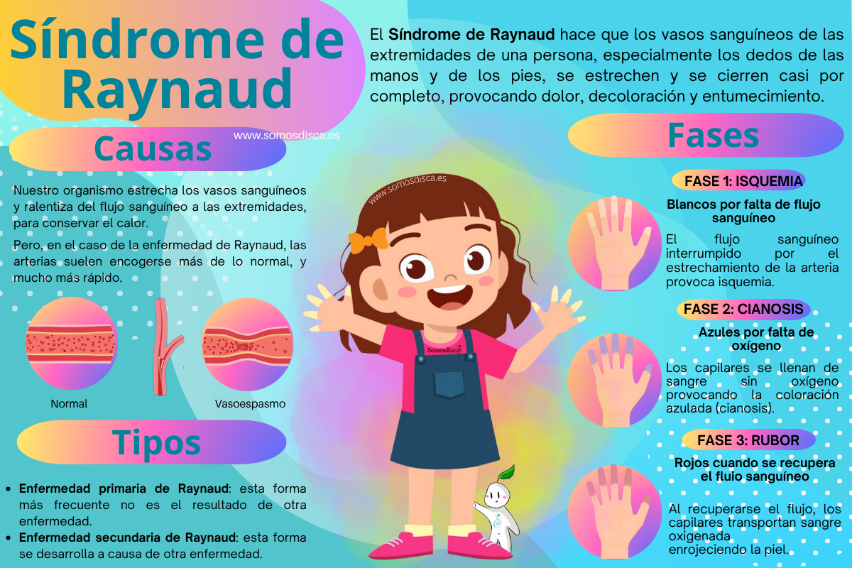 INFOGRAFÍA síndrome de raynaud INFOGRAFÍA síndrome de raynaud