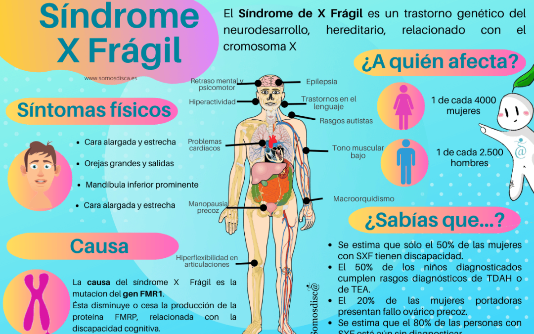 Infografía Síndrome de X Frágil