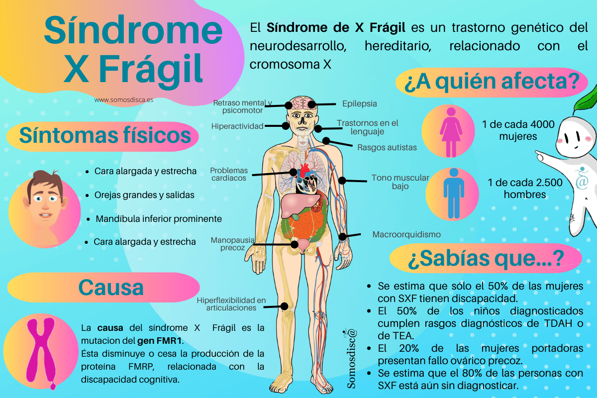 Infografía Síndrome De X Frágil Somosdisc
