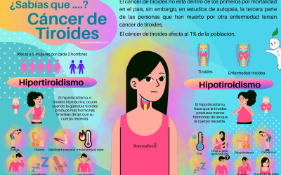 Infografía del cáncer de tiroides