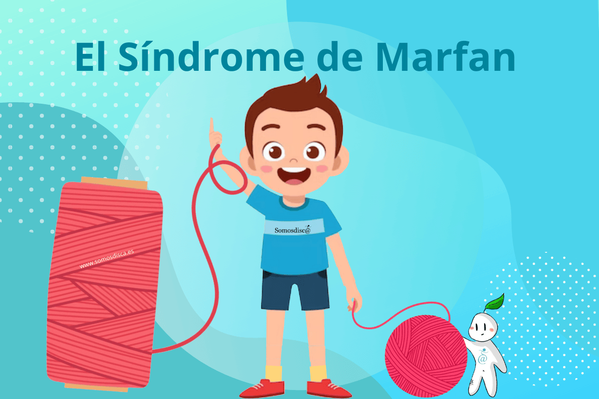 El Síndrome de Marfan .