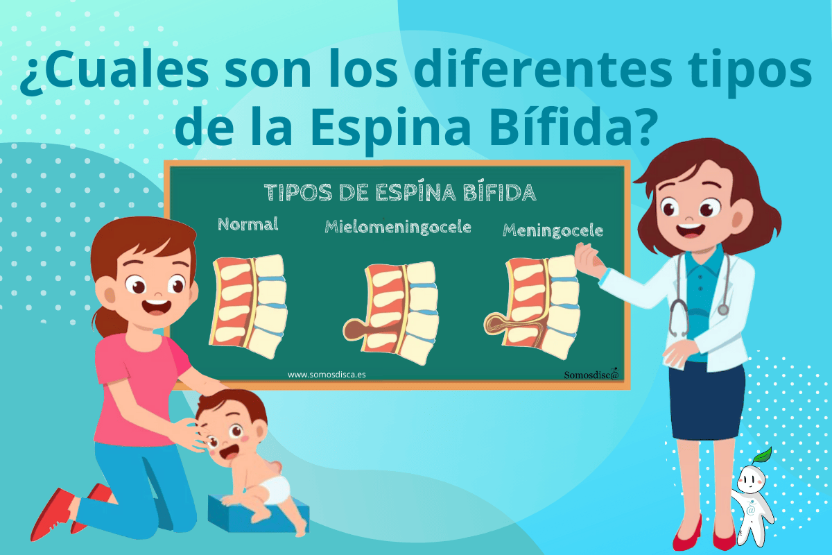 ¿Cuales son los diferentes tipos de la Espina Bífida