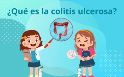 ¿Qué es la colitis ulcerosa?