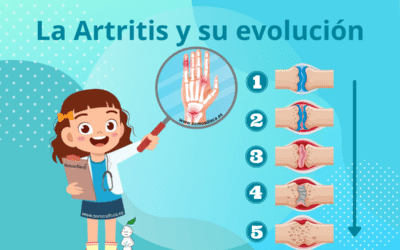 Día Mundial de la Artritis 2025