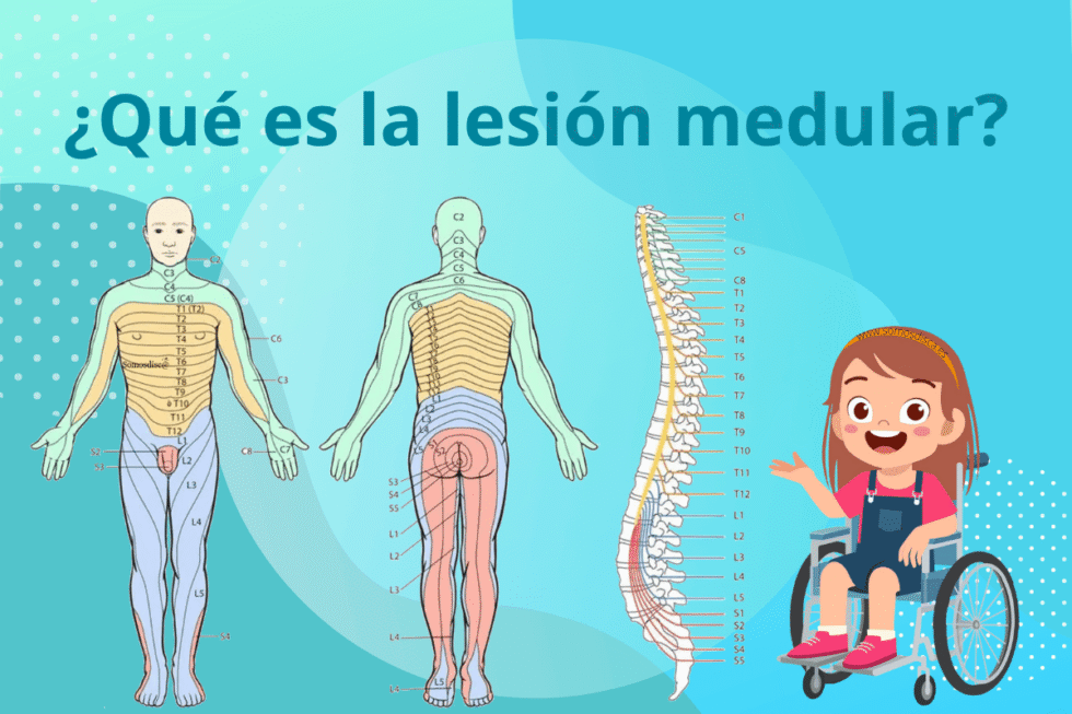 ¿En que consiste una lesion medular? - Somosdisc@