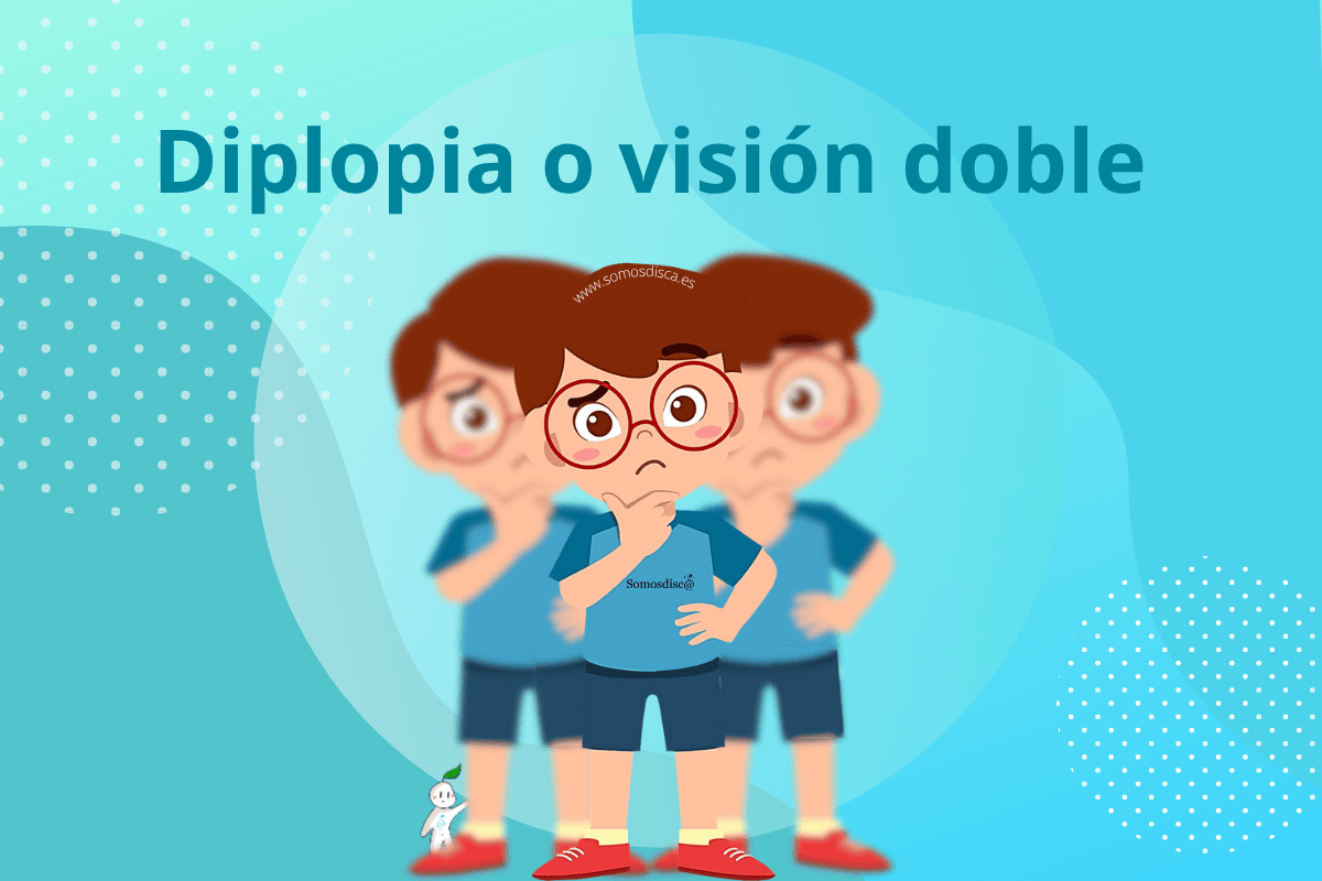 diplopia o visión doble diplopia o visión doble